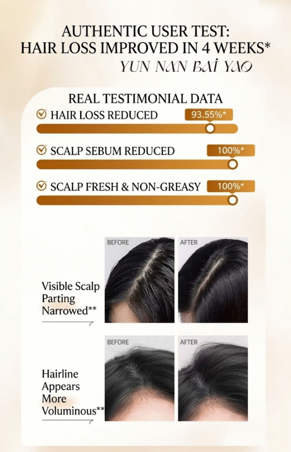 Yangyuanqing Anti-Hair Loss Shampoo (500ml)